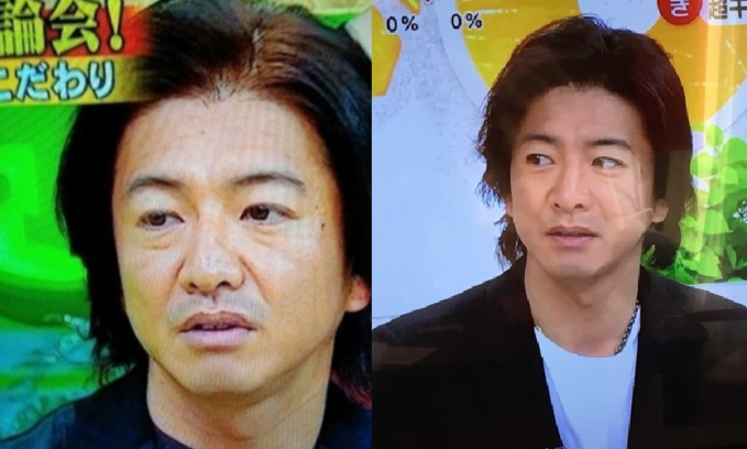 아스퍼거 외모.png
