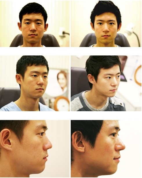 남자 성괴.jpg